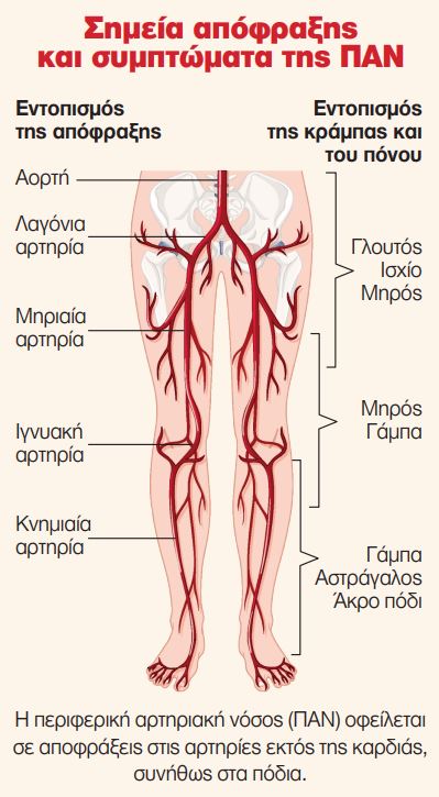 Αντιδράστε για να αποφύγετε τις επιπλοκές της ΠΑΝ-1