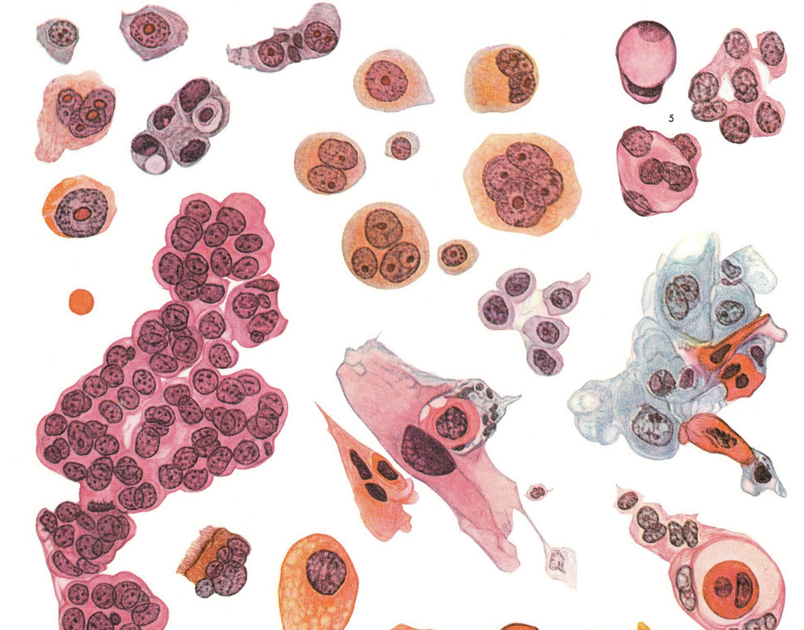 Γεώργιος Ν. Παπανικολάου: Ο κύριος «Παπ Τεστ»-8