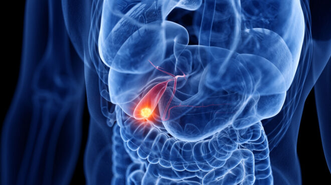 χοληδόχος-κύστη-ένα-παραμελημένο-όργ-562550611