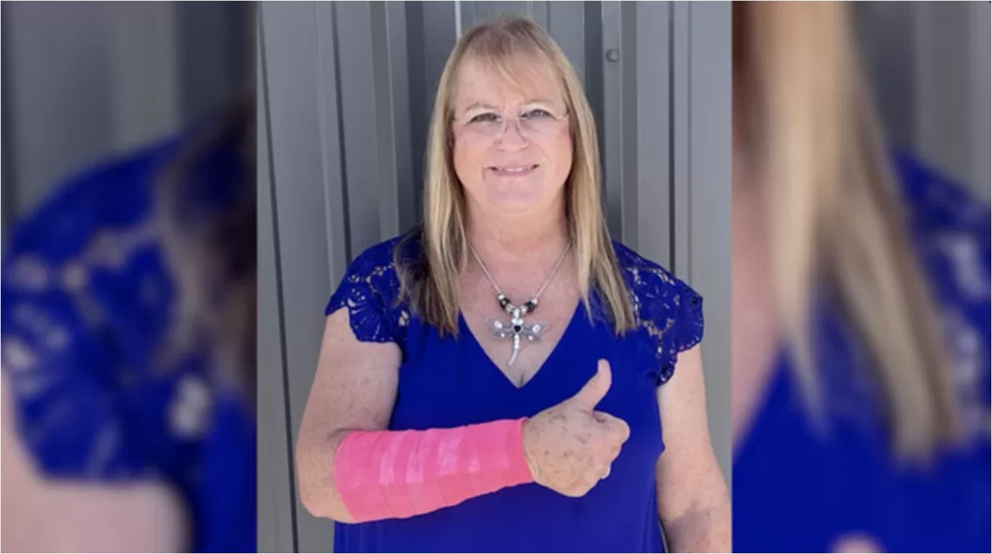 ΗΠΑ: Τεξανή δέχθηκε διπλή επίθεση από… γεράκι και φίδι-1