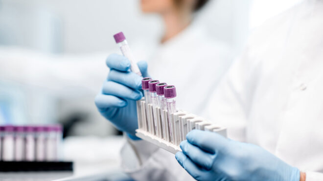 λεπτοσπείρωση-κλιμάκιο-του-εοδυ-στην-562637755