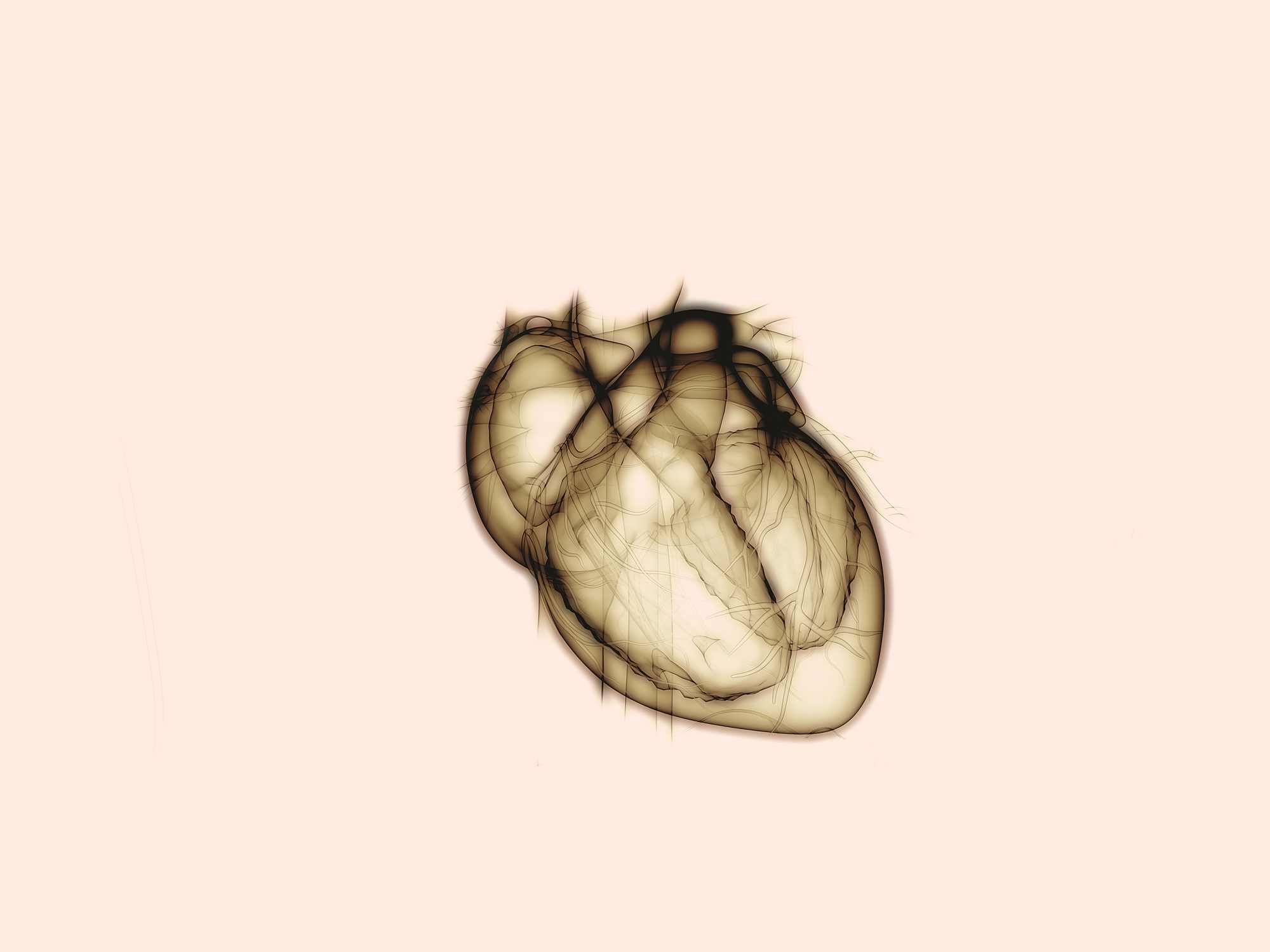 Τα αυτοάνοσα νοσήματα απειλούν την καρδιά-1