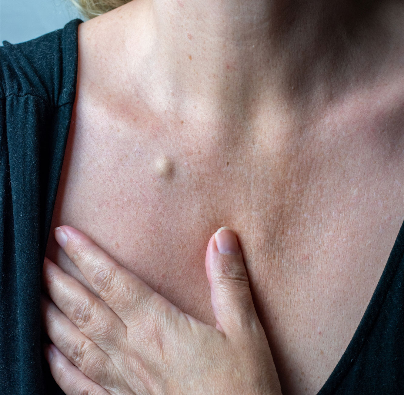 Η αλήθεια για τα γρομπαλάκια-1