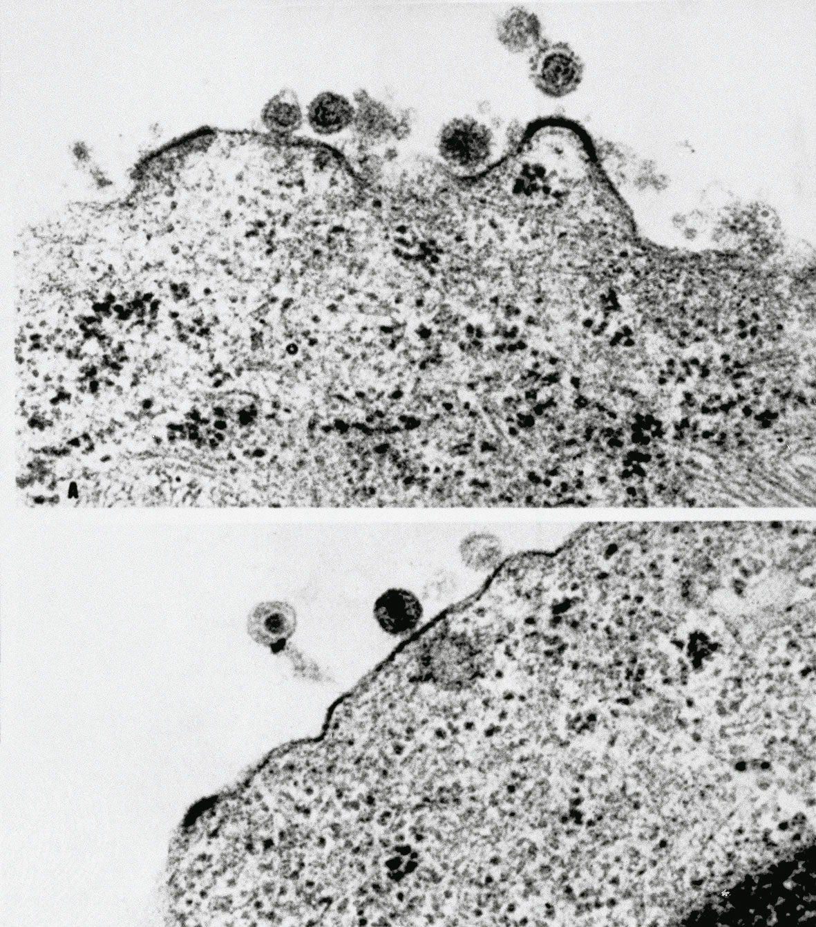 Η μυστηριώδης νόσος του AIDS – Από το στίγμα στην ενημέρωση-1
