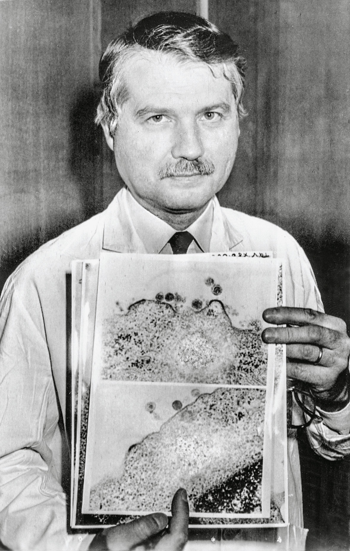 Η μυστηριώδης νόσος του AIDS – Από το στίγμα στην ενημέρωση-6