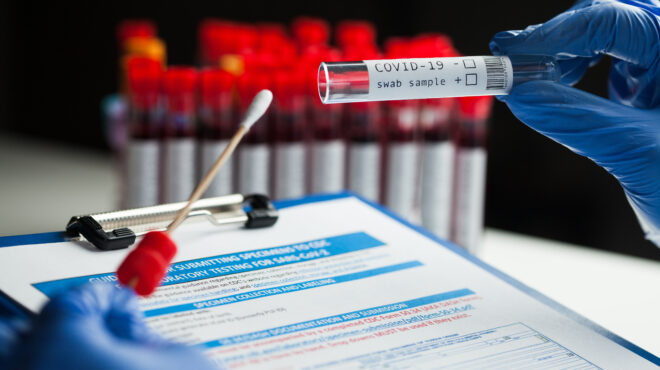 η-covid-19-συνδέεται-με-αυξημένο-κίνδυνο-εμφά-562681060