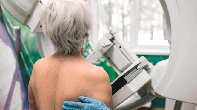 η-θεραπεία-για-τον-καρκίνο-του-μαστού-δ-562677193