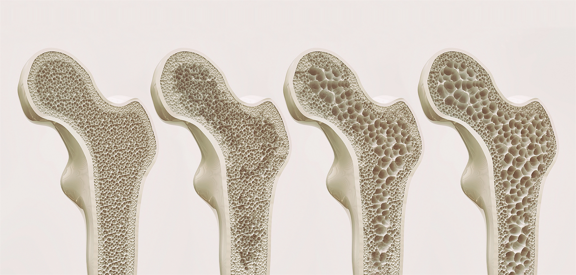 Αναμφίβολα ανδρικό πρόβλημα-1