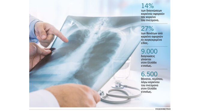 καρκίνος-του-πνεύμονα-απέναντι-στη-νό-562721062