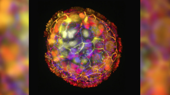 anthrobots-επιστήμονες-έφτιαξαν-ρομπότ-από-αν-562760107