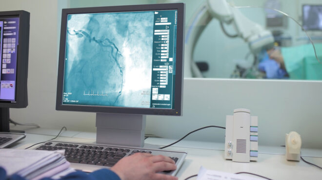 εχετε-καρδιακή-ανεπάρκεια-αποφύγετε-562767919