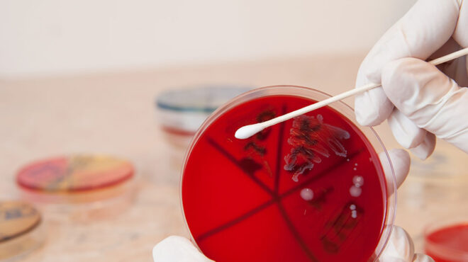 εοδυ-22-νεκροί-από-διεισδυτικό-στρεπτόκ-562853281