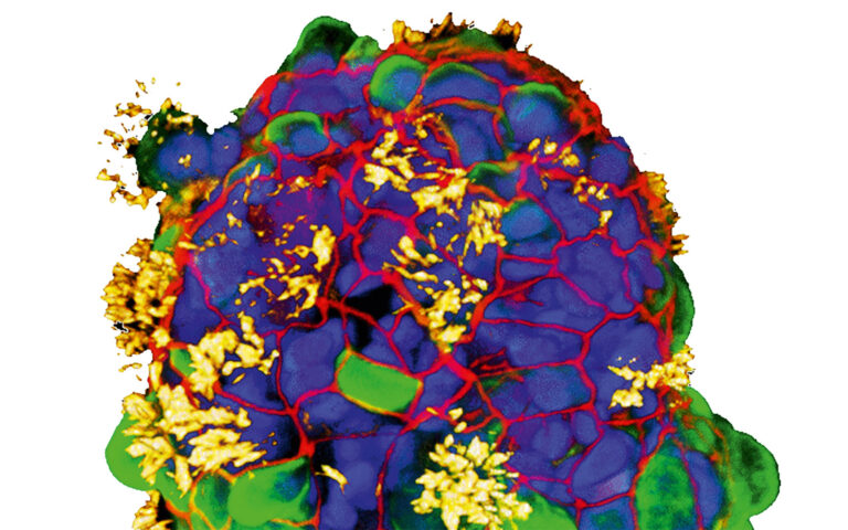 Τι είναι τα «ανθρωμπότ» και πώς θα αλλάξουν την ιατρική