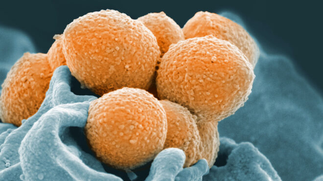 δεύτερος-θάνατος-από-στρεπτόκοκκο-ο-562868716