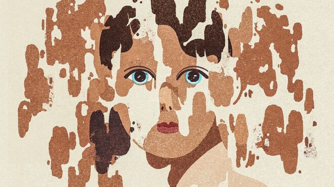 γιατί-τα-αυτοάνοσα-προτιμούν-τις-γυνα-562863739