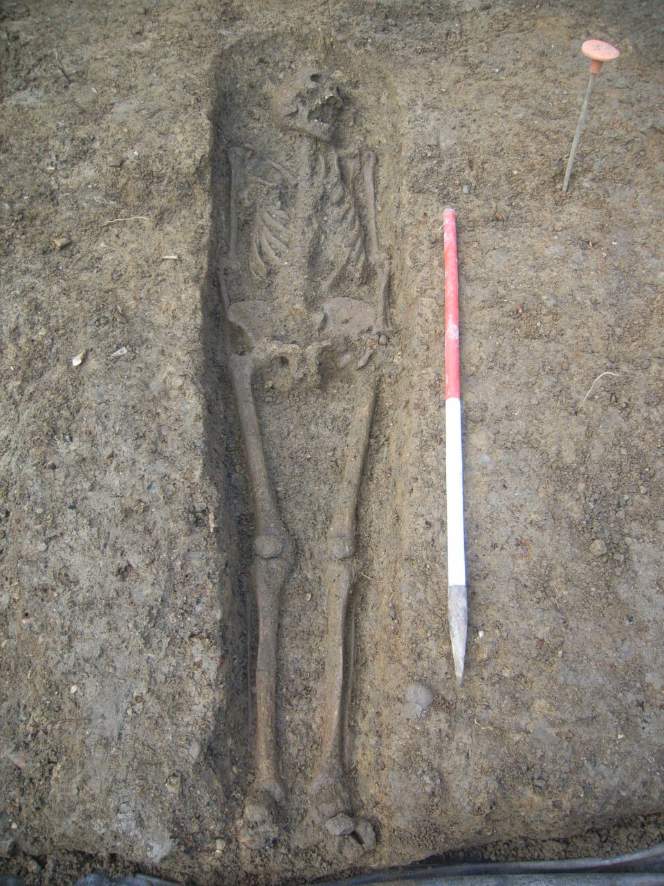 Το βρέφος με σύνδρομο Down που έζησε στην εποχή του Σιδήρου-5