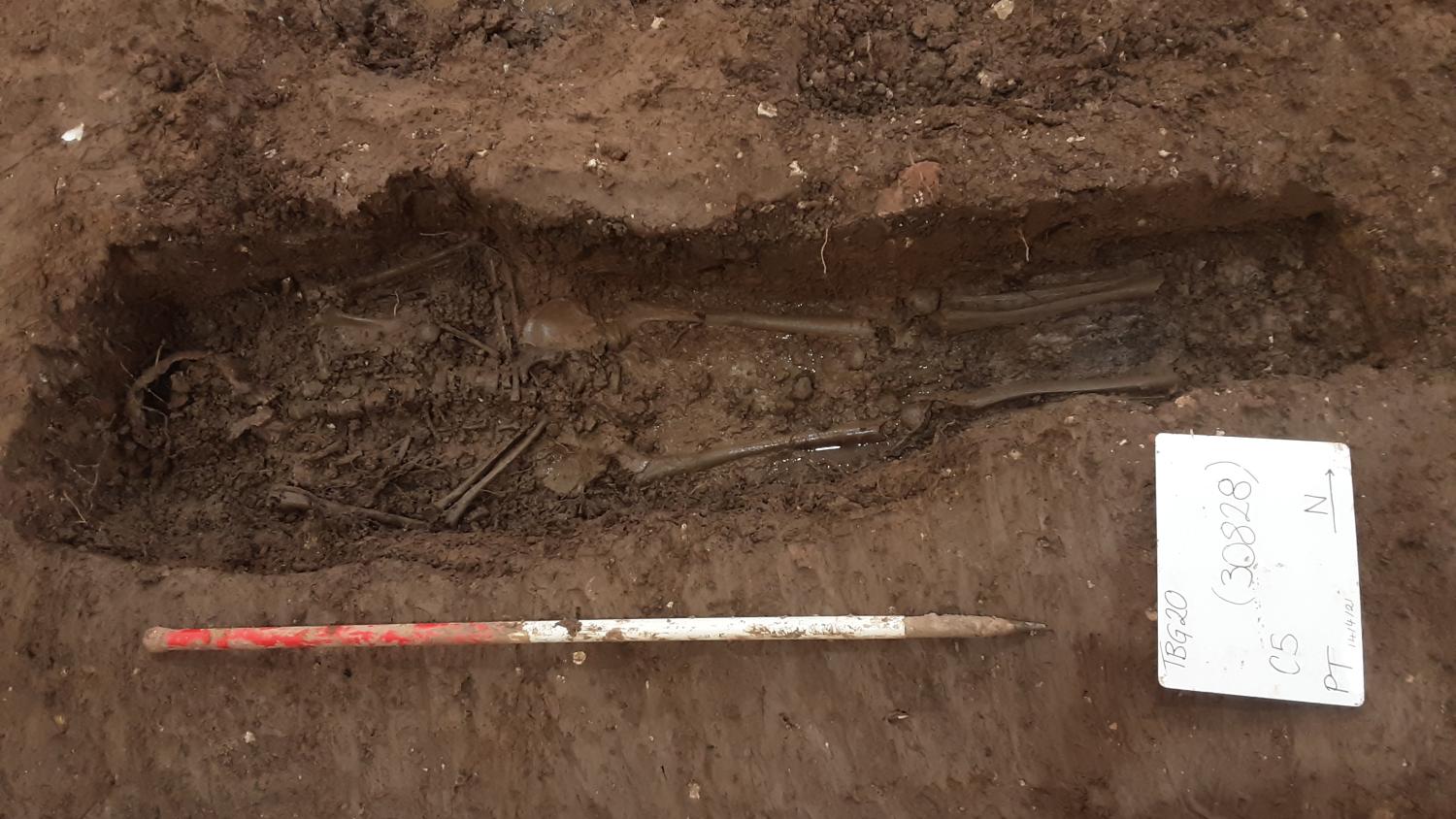 Το βρέφος με σύνδρομο Down που έζησε στην εποχή του Σιδήρου-4