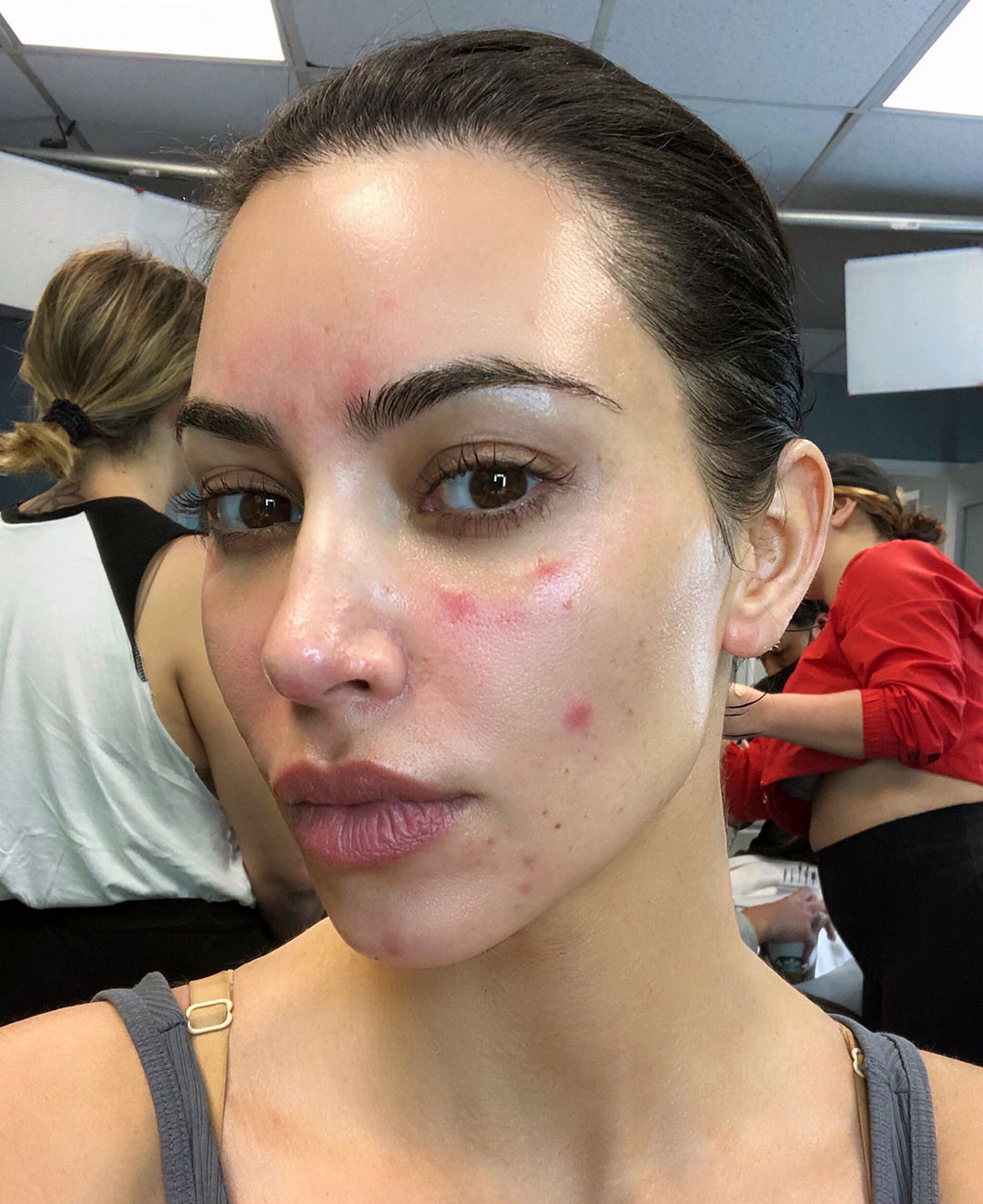 Τι πυροδοτεί υποκείμενα αυτοάνοσα νοσήματα – Ασθενείς και ειδικοί μιλούν στην «Κ»-1