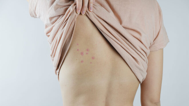 εισβολή-κοριών-562895449