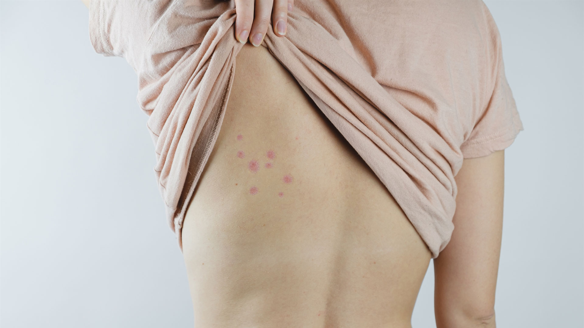 εισβολή-κοριών-562895449