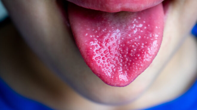 στρεπτόκοκκος-ενα-στα-τέσσερα-παιδιά-562871374