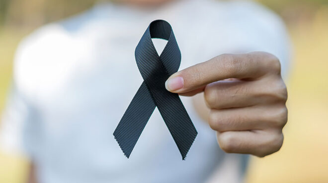 φαλακρές-βγείτε-έξω-562872742