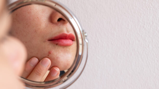 ηπα-υψηλά-επίπεδα-καρκινογόνου-ουσία-562920571