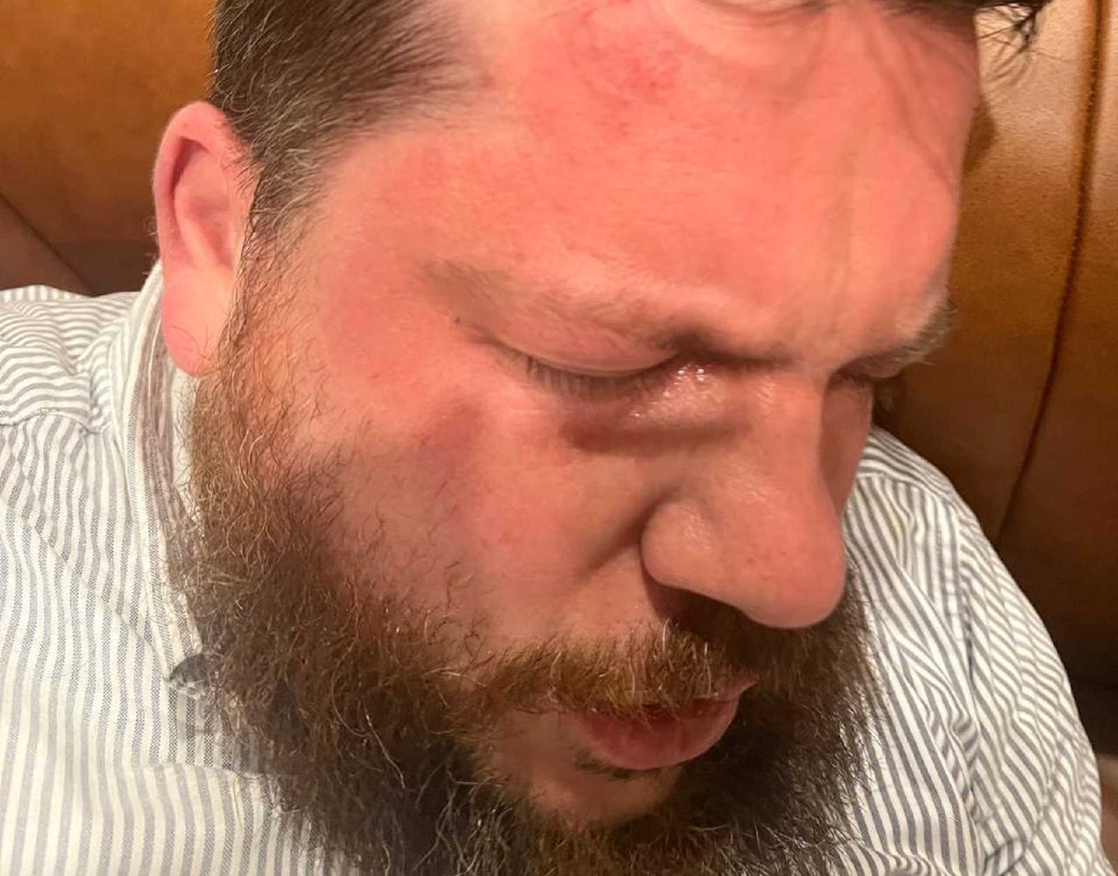 Λιθουανία: Επίθεση με σφυρί δέχθηκε συνεργάτης του Αλεξέι Ναβάλνι-1