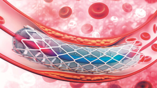 εχει-νόημα-η-ενδοπρόθεση-στη-σταθερή-σ-562930990