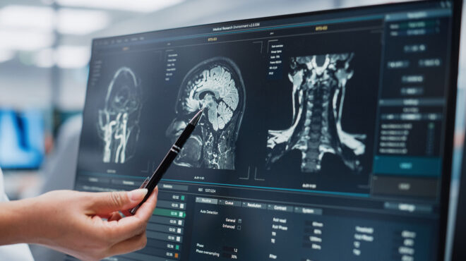 η-επιταχυνόμενη-γήρανση-πίσω-από-πε-562971172