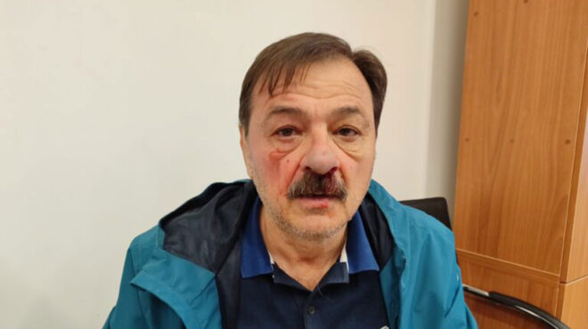 βόλος-επίθεση-με-γροθιές-σε-δημοτικό-σ-562967134