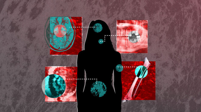 η-ακτινογραφία-21-865-καταγγελιών-ενδοοικ-562982296