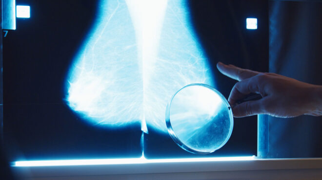 προλαμβάνω-δωρεάν-προληπτικές-εξε-563000944