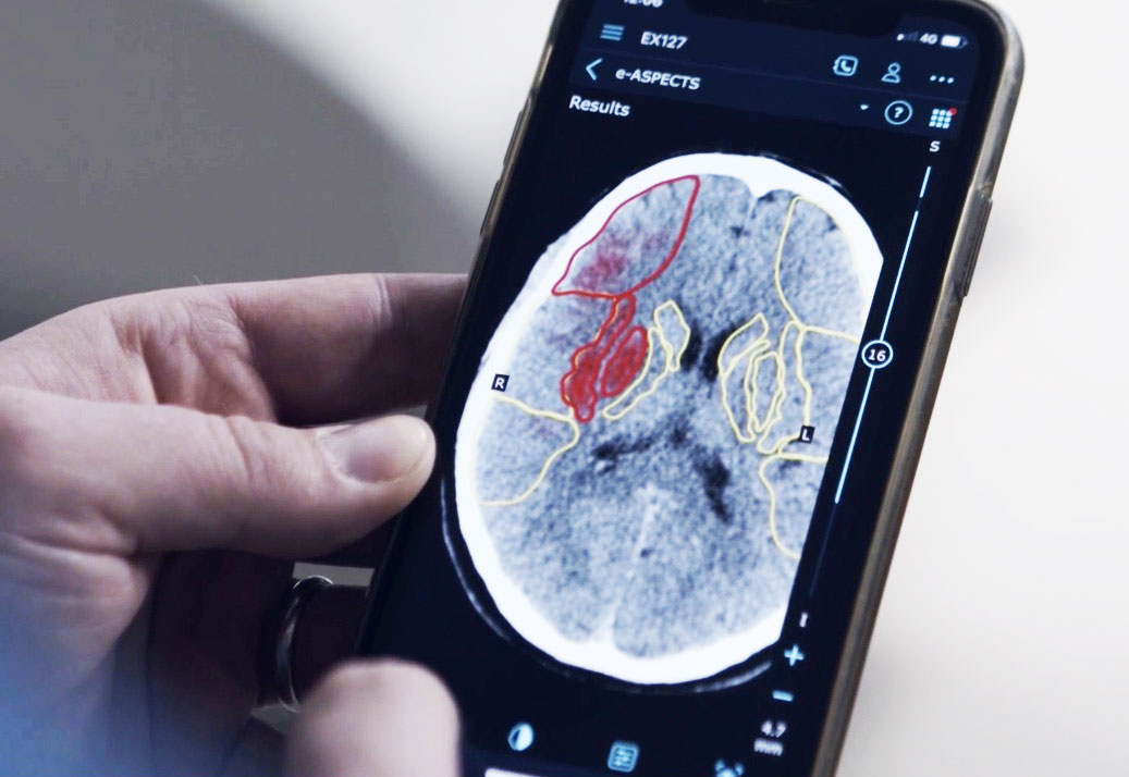 Διαπρέπουν οι startups της διασποράς-1