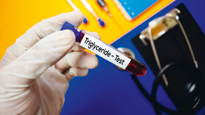 eλεγχος-των-υψηλών-τριγλυκεριδίων-563049508