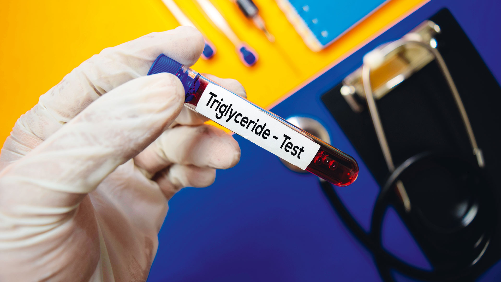 eλεγχος-των-υψηλών-τριγλυκεριδίων-563049508