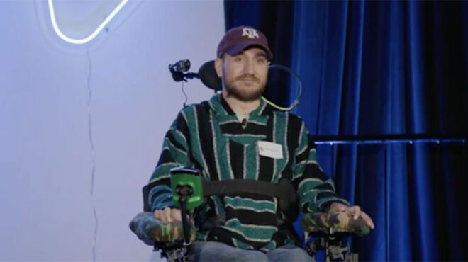 neuralink-προβλήματα-στο-πρώτο-εμφύτευμα-σε-ά-563017183