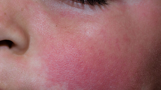 θεσσαλονίκη-πέθανε-2χρονο-κοριτσάκι-π-563030029