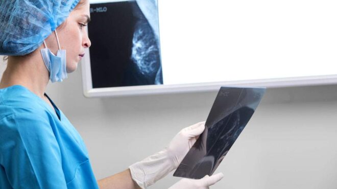 επέκταση-των-δωρεάν-μαστογραφιών-σε-γ-563018914