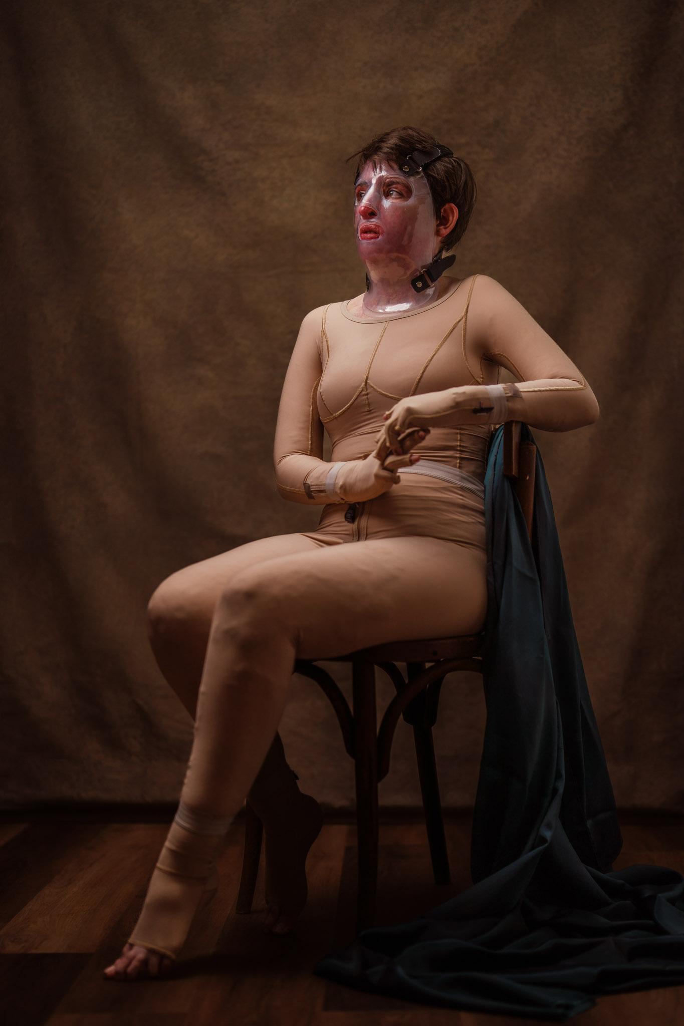 Ζώντας με το έγκαυμα-1