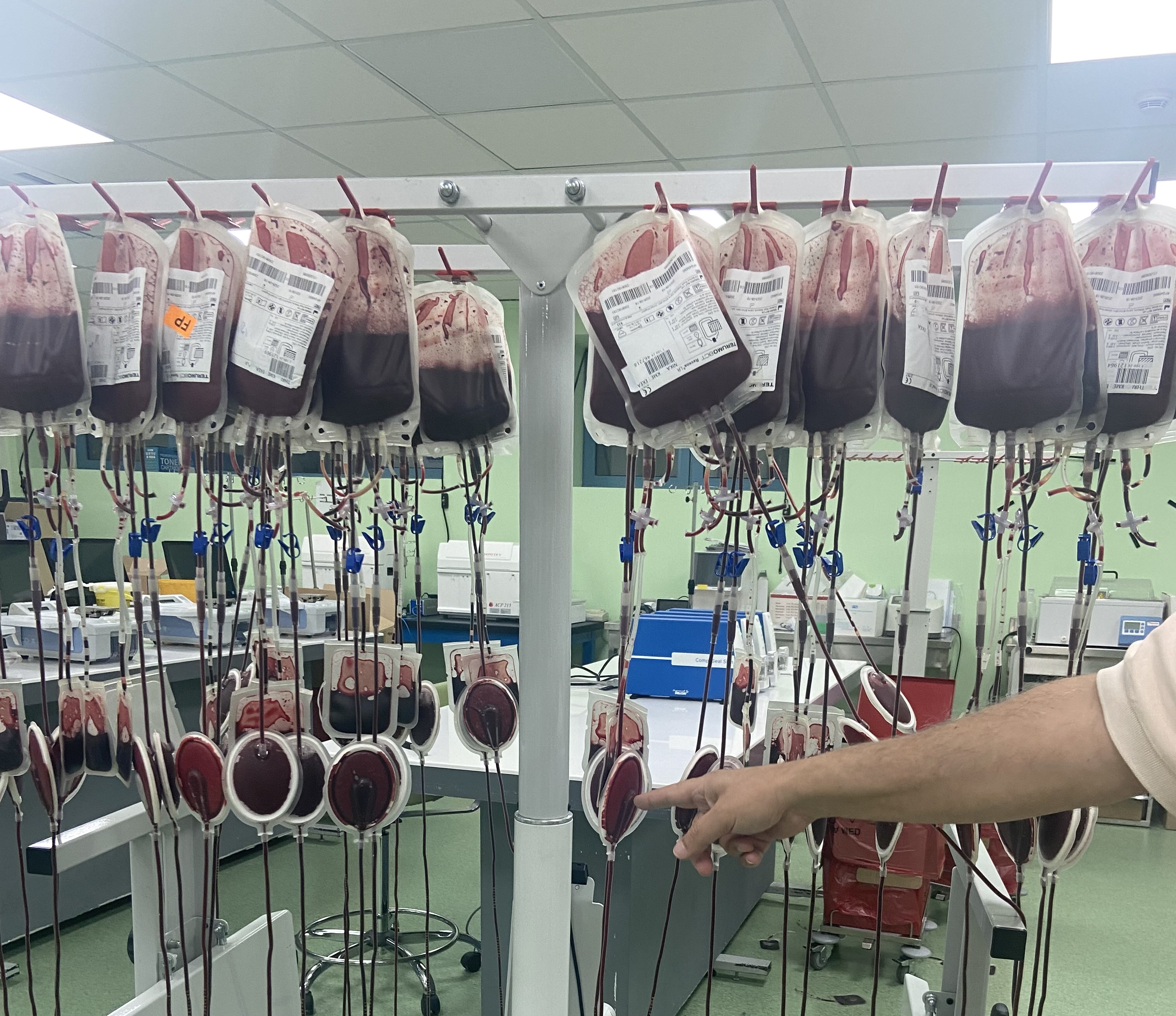 «Στα ψυγεία έχουμε 50.000 λίτρα πλάσματος από το 2008, τα οποία δεν μπορούμε να αξιοποιήσουμε»-2