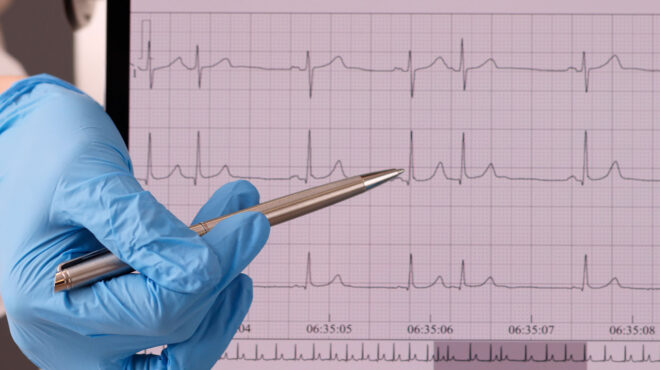 oταν-η-καρδιά-ξαφνικά-αρχίζει-να-χτυπά-γ-563096611