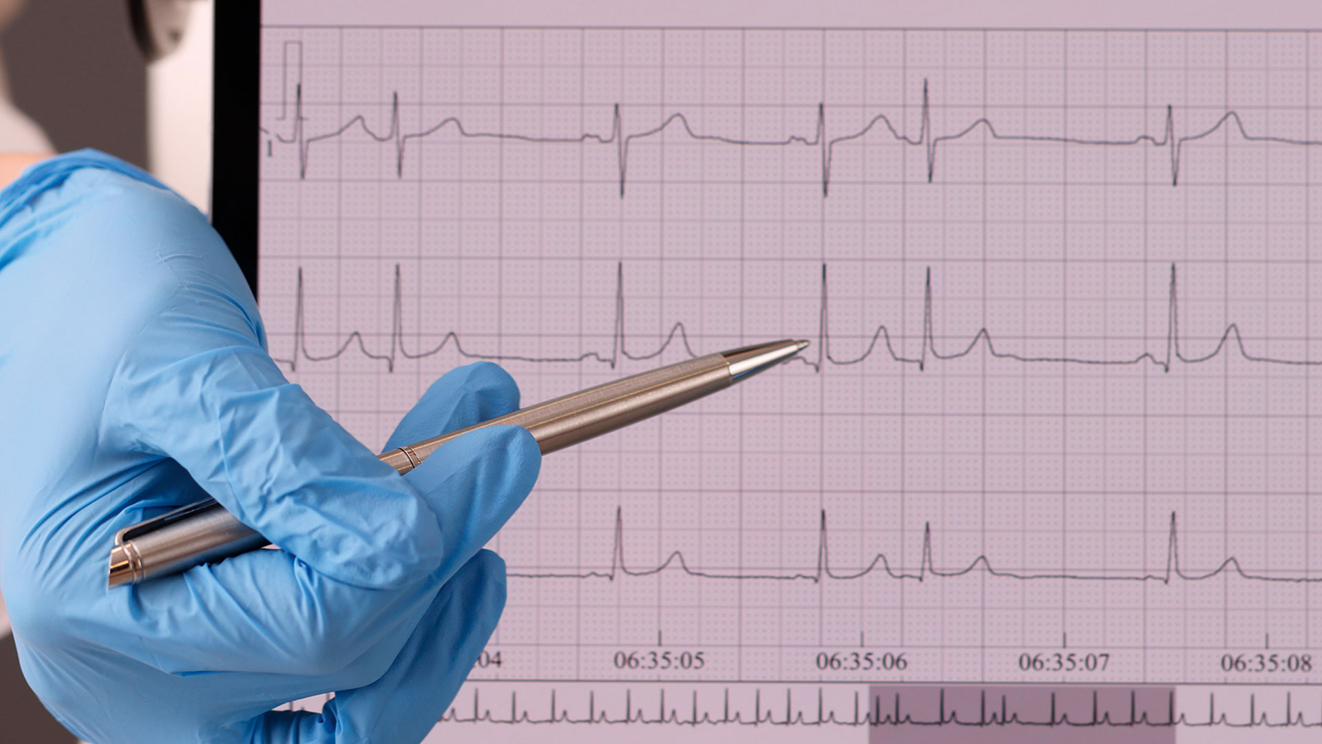 oταν-η-καρδιά-ξαφνικά-αρχίζει-να-χτυπά-γ-563096611