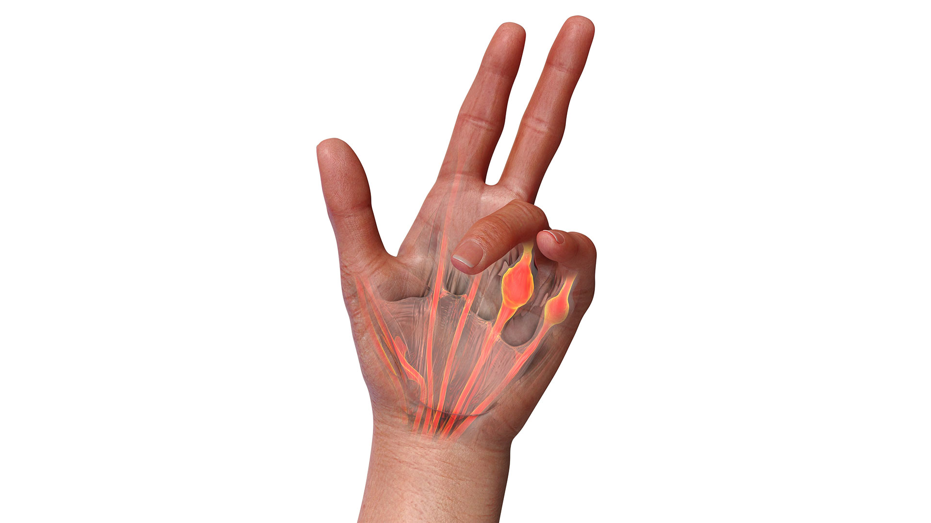 οι-καλύτερες-θεραπείες-για-ένα-συχνό-π-563087371