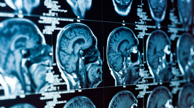 κορυφαίος-επιστήμονας-λέει-ότι-τον-εμ-563058055