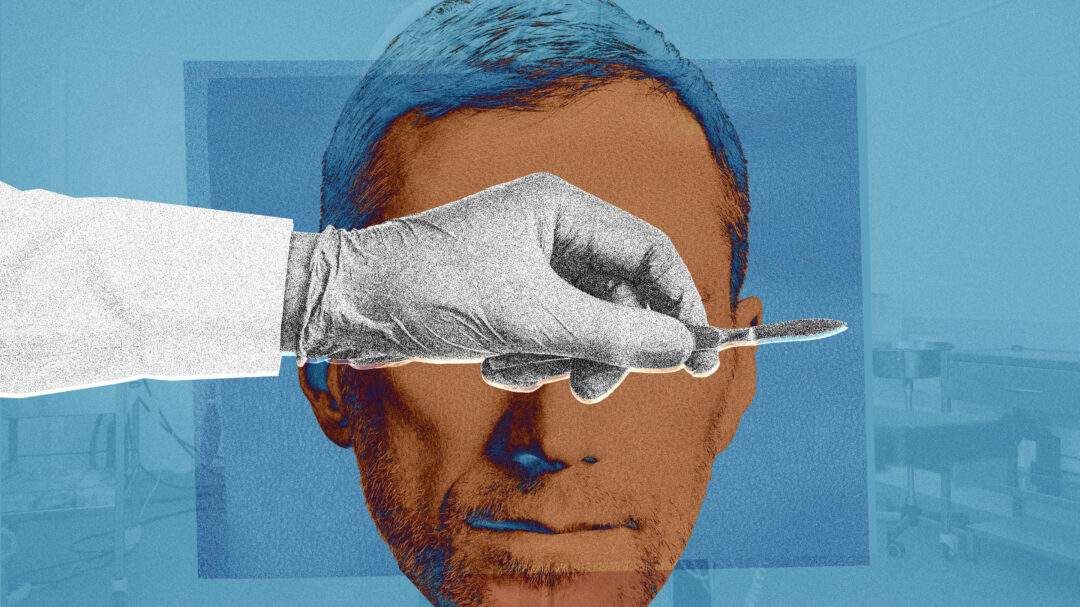 τι-ζητούν-οι-άνδρες-από-τον-πλαστικό-το-563087029