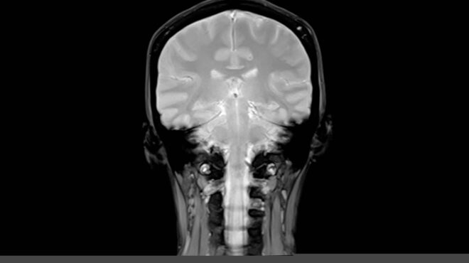 ο-εγκέφαλος-που-ξεγελούσε-το-αλτσχά-563088388