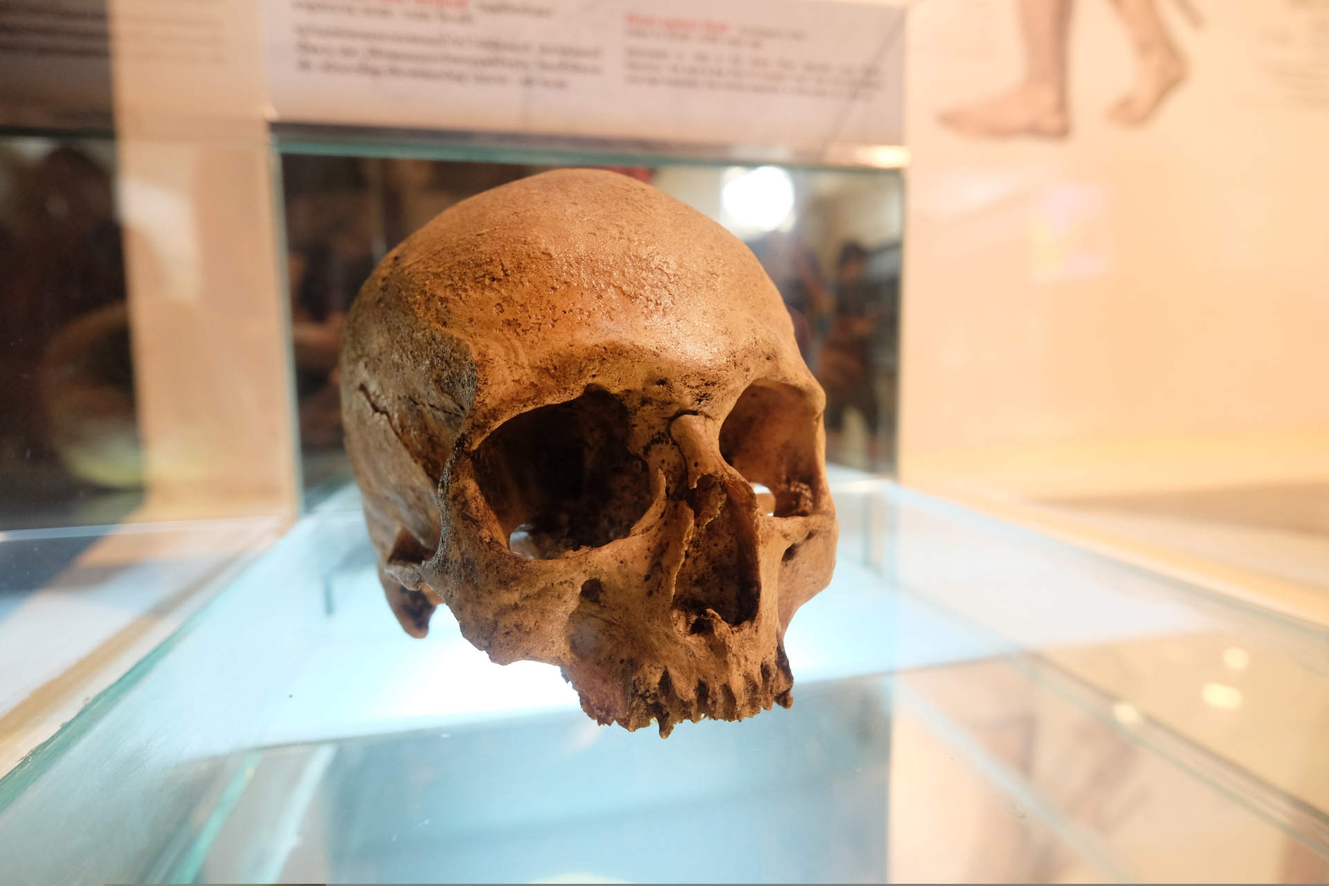 Γιατί έχει συρρικνωθεί ο ανθρώπινος εγκέφαλος-1