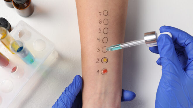 οι-αλλεργίες-ευθύνονται-για-180-000-θανάτου-563115241