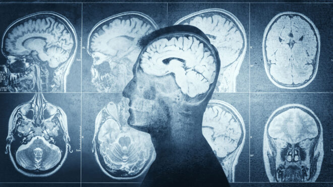 ψυχές-στο-χειρουργικό-τραπέζι-563148172